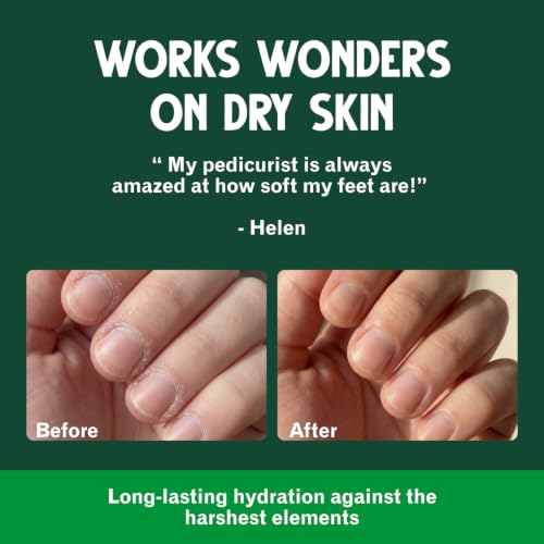 Bag Balm Vermont's Original Skin Moisturizer - Full Body Hydrating Skin Care: Dry Hands, Lips, Face, Feet & More - Unscented, Cruelty & Paraben Free - Day & Night, Men & Women (4oz Tin, Made in USA) | camping-soaps-and-shampoos - size: 4 Ounce (Pack of 1)